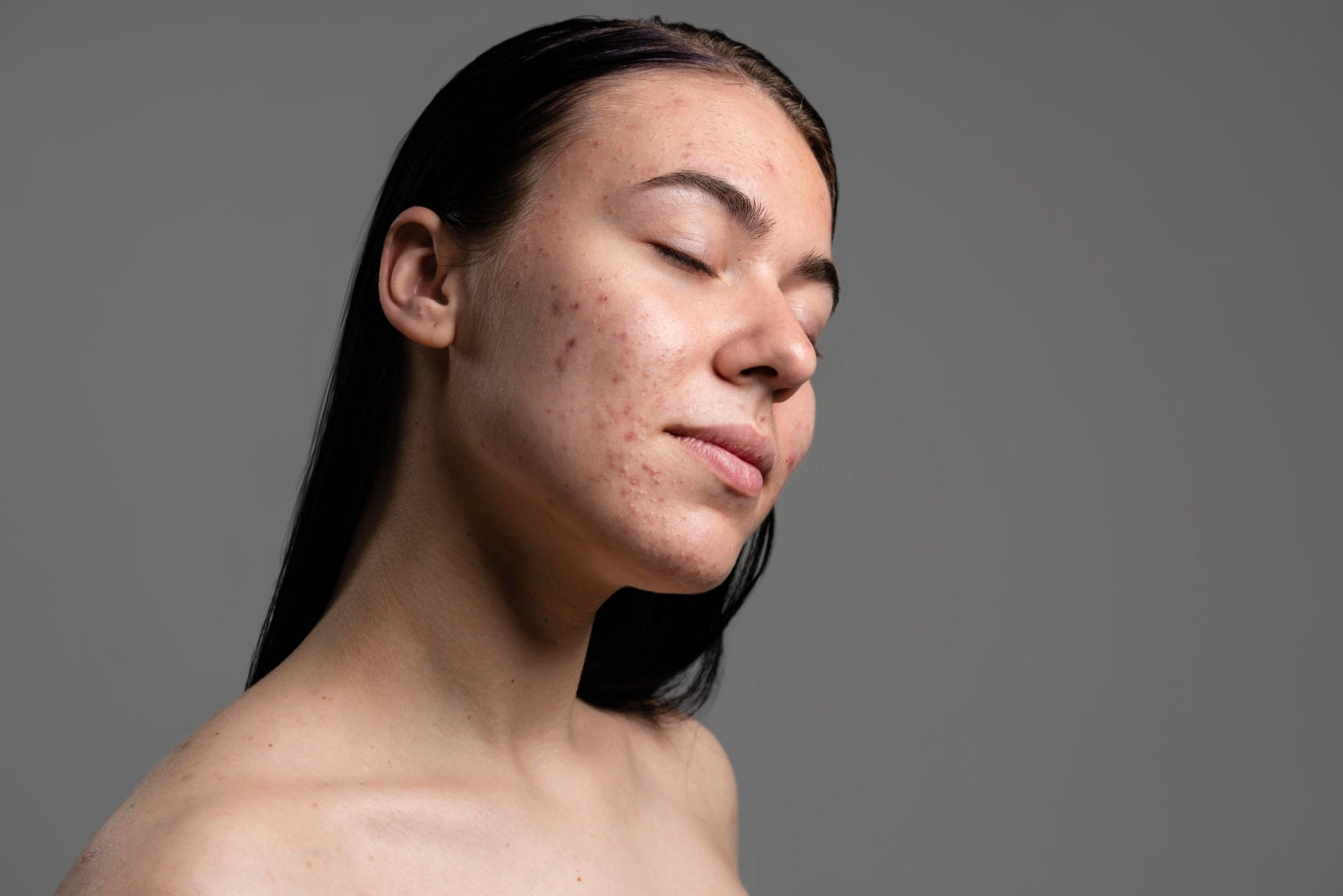 Understanding Stubborn Pigmentation: Unlocking the Secrets to Clearer Skin